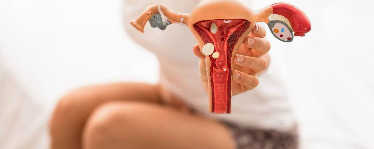 Incidencija razvoja endometrioze